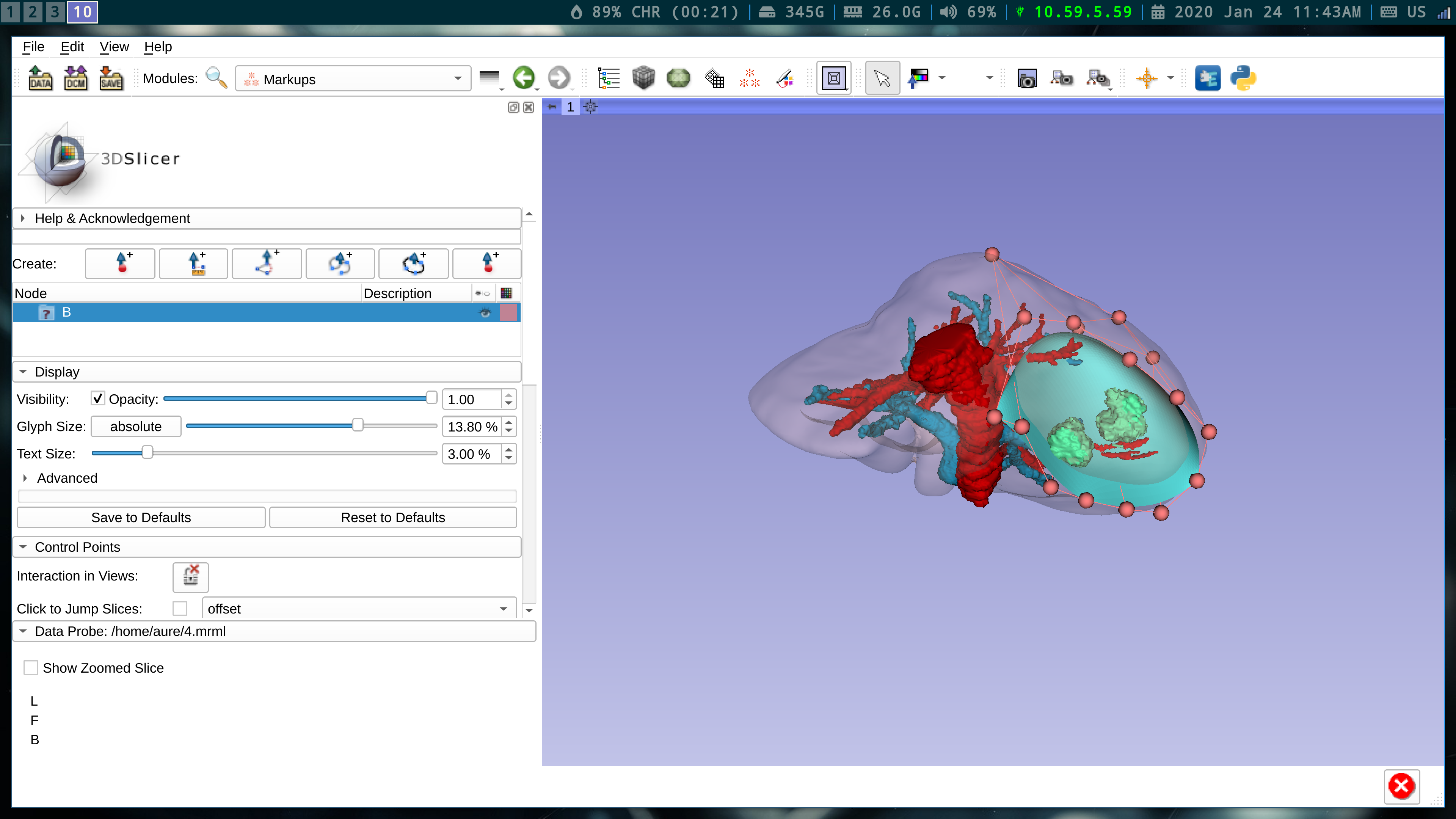 3D Bezier Surface Markup